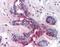 Dug antibody, GTX85616, GeneTex, Immunohistochemistry paraffin image 