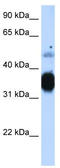 fTnT antibody, TA339176, Origene, Western Blot image 