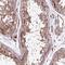 Spermatogenesis Associated Serine Rich 2 antibody, NBP1-82269, Novus Biologicals, Immunohistochemistry paraffin image 