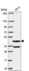 RFX Family Member 8, Lacking RFX DNA Binding Domain antibody, NBP2-58601, Novus Biologicals, Western Blot image 