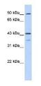 2'-5'-Oligoadenylate Synthetase 1 antibody, ab86343, Abcam, Western Blot image 