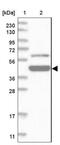 Zinc Finger And BTB Domain Containing 9 antibody, NBP1-92611, Novus Biologicals, Western Blot image 
