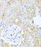 Pyruvate Dehydrogenase Kinase 3 antibody, FNab06278, FineTest, Immunohistochemistry frozen image 