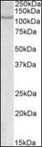 Nuclear Factor Of Activated T Cells 2 antibody, orb89730, Biorbyt, Western Blot image 