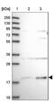 Solute Carrier Family 41 Member 3 antibody, NBP2-48837, Novus Biologicals, Western Blot image 