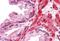 RAK antibody, NBP1-28857, Novus Biologicals, Immunohistochemistry paraffin image 