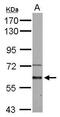 Activin A Receptor Type 1 antibody, PA5-28662, Invitrogen Antibodies, Western Blot image 