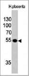 Ornithine Decarboxylase 1 antibody, orb388533, Biorbyt, Western Blot image 