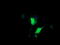 Cancer/Testis Antigen 1B antibody, LS-C174396, Lifespan Biosciences, Immunofluorescence image 