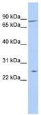 Zinc Finger Protein 613 antibody, TA341401, Origene, Western Blot image 