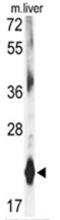 Dihydrofolate Reductase antibody, AP17565PU-N, Origene, Western Blot image 