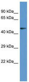 Pantothenate kinase 2, mitochondrial antibody, TA343077, Origene, Western Blot image 