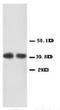 C-X-C Motif Chemokine Receptor 2 antibody, AP23279PU-N, Origene, Western Blot image 