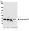 Peroxiredoxin 3 antibody, A304-744A, Bethyl Labs, Western Blot image 
