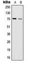 Interleukin 17 Receptor C antibody, MBS821475, MyBioSource, Western Blot image 