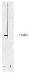 Serine/threonine-protein phosphatase 2A 55 kDa regulatory subunit B beta isoform antibody, AP05043PU-N, Origene, Western Blot image 