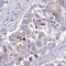 Chromosome 14 Open Reading Frame 178 antibody, HPA062581, Atlas Antibodies, Immunohistochemistry paraffin image 