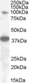 Mediator Complex Subunit 24 antibody, EB08015, Everest Biotech, Western Blot image 