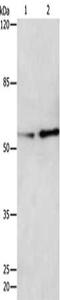 Cyclase Associated Actin Cytoskeleton Regulatory Protein 1 antibody, CSB-PA256310, Cusabio, Western Blot image 