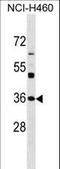 N(Alpha)-Acetyltransferase 80, NatH Catalytic Subunit antibody, LS-C158361, Lifespan Biosciences, Western Blot image 