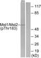 Serine/Threonine Kinase 4 antibody, PA5-38372, Invitrogen Antibodies, Western Blot image 
