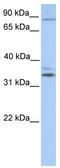 Neuronal PAS Domain Protein 2 antibody, TA335817, Origene, Western Blot image 