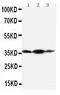 Podoplanin antibody, PA1411, Boster Biological Technology, Western Blot image 