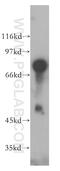 Basic Helix-Loop-Helix Family Member E41 antibody, 12688-1-AP, Proteintech Group, Western Blot image 