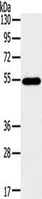 CASP8 And FADD Like Apoptosis Regulator antibody, TA351195, Origene, Western Blot image 