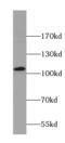 Anoctamin-2 antibody, FNab00442, FineTest, Western Blot image 