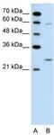 Guanidinoacetate N-Methyltransferase antibody, TA346164, Origene, Western Blot image 