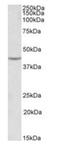 VEGF antibody, orb12277, Biorbyt, Western Blot image 