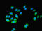 5'-Nucleotidase, Cytosolic IA antibody, LS-C285811, Lifespan Biosciences, Immunofluorescence image 