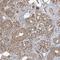 LDOC1 Regulator Of NFKB Signaling antibody, HPA051768, Atlas Antibodies, Immunohistochemistry frozen image 