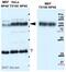 Lysosomal Associated Membrane Protein 2 antibody, ab18529, Abcam, Western Blot image 