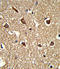 HLA class II histocompatibility antigen, DRB1-15 beta chain antibody, LS-C203667, Lifespan Biosciences, Immunohistochemistry paraffin image 