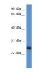 Src-like-adapter 2 antibody, orb326345, Biorbyt, Western Blot image 