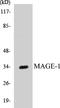 MAGE Family Member A1 antibody, EKC1342, Boster Biological Technology, Western Blot image 
