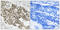 Serine/threonine-protein kinase ATR antibody, LS-C118345, Lifespan Biosciences, Immunohistochemistry paraffin image 