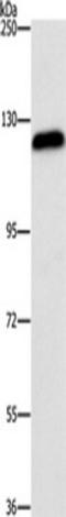 Arf-GAP with GTPase, ANK repeat and PH domain-containing protein 2 antibody, TA351073, Origene, Western Blot image 