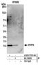 Huntingtin Interacting Protein K antibody, A305-737A-M, Bethyl Labs, Immunoprecipitation image 