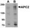 APC Regulator Of WNT Signaling Pathway 2 antibody, NBP1-77376, Novus Biologicals, Western Blot image 