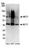 Monocarboxylate transporter 1 antibody, A304-358A, Bethyl Labs, Western Blot image 