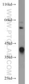 ADH4 antibody, 16474-1-AP, Proteintech Group, Western Blot image 