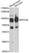 Rabphilin 3A antibody, LS-C748628, Lifespan Biosciences, Western Blot image 