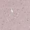 Coiled-Coil Domain Containing 114 antibody, PA5-60012, Invitrogen Antibodies, Immunohistochemistry paraffin image 