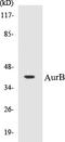 Aurora Kinase B antibody, EKC1049, Boster Biological Technology, Western Blot image 
