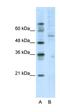 Cyclic AMP-dependent transcription factor ATF-7 antibody, orb330022, Biorbyt, Western Blot image 