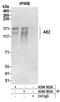 AE 2 antibody, A304-503A, Bethyl Labs, Immunoprecipitation image 