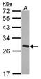 FKBP Prolyl Isomerase 7 antibody, NBP2-16499, Novus Biologicals, Western Blot image 